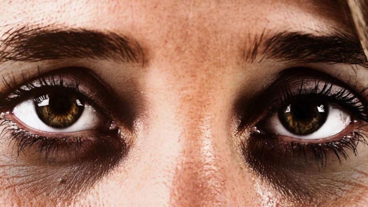 dark circles