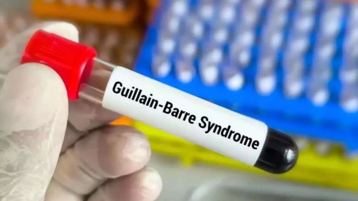 Guillain-Barre syndrome